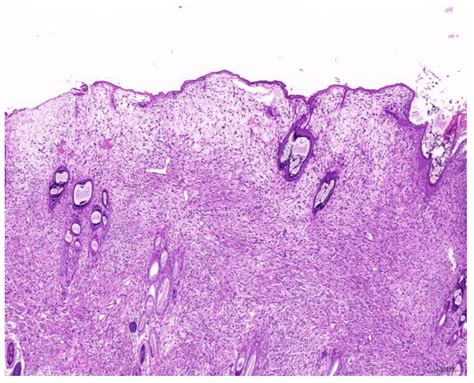 Common Diagnoses from Surgical Biopsies and Investigation of ...