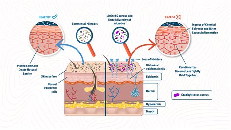 Image result for Microarray eQTL