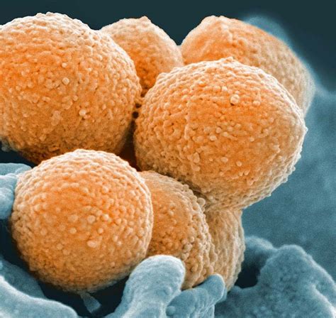 STREP 的图像结果