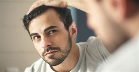 Balding: Causes, Symptoms And Treatment