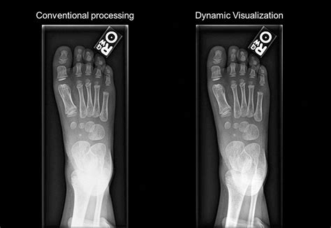 Image result for Fuji Dynamic Visualization