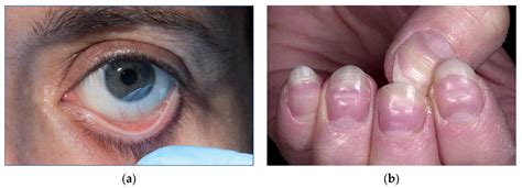 A New Artificial Intelligence Approach Using Extreme Learning Machine ...