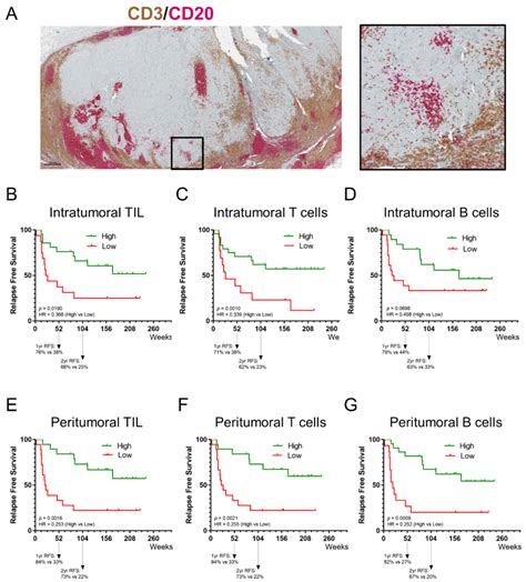 Low-Dose Nivolumab with or without Ipilimumab as Adjuvant Therapy ...