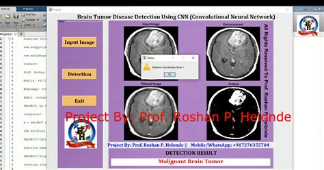 Image result for Brain Tumor Detection Using MATLAB