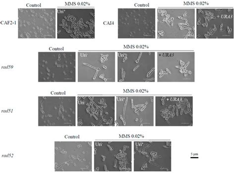 Genes | Special Issue : Fungal Pathogenesis in Humans: The Growing Threat