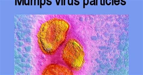 Image result for Mumps Operating System Computer Science