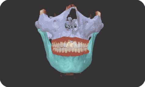 DTX Studio Clinic Imaging Software | DEXIS