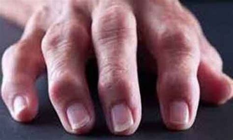 Read all Latest Updates on and about musculoskeletal pain