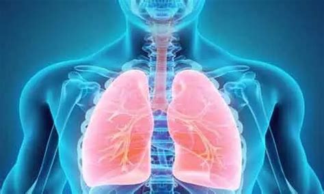 Oral anticoagulant use increases bleeding risk in untreated respiratory ...