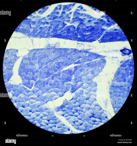 Smooth muscle microscope hi-res stock photography and images - Alamy