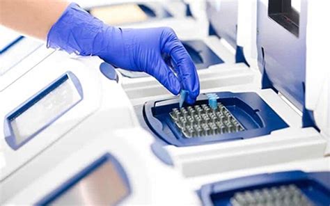 qPCR Method 的图像结果