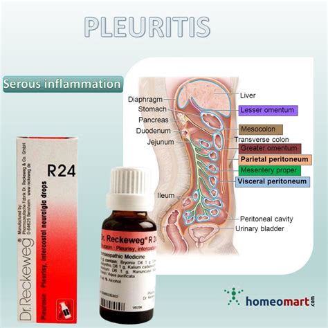 R24 Drops for Serous Inflammation, Pleuritis & Arthritis – Dr. Reckeweg ...