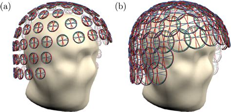 Image result for Elekta Sensor Array
