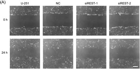 Inhibition of REST Suppresses Proliferation and Migration in ...