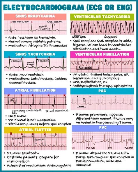 ResusMed LLC on LinkedIn: EKG Cheat Sheets