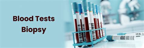 Top Blood Tests & Biopsy Services in Chandanagar