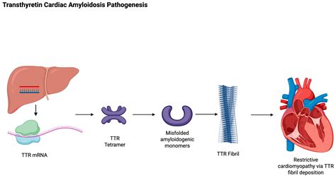 Transthyretin Amyloid Cardiomyopathy Treatment: An Updated Review