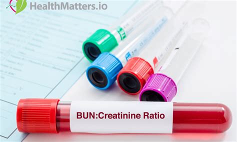 What is the BUN to Creatinine ratio?