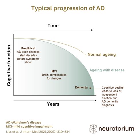 Typical progression of Alzheimer’s disease - Neurotorium