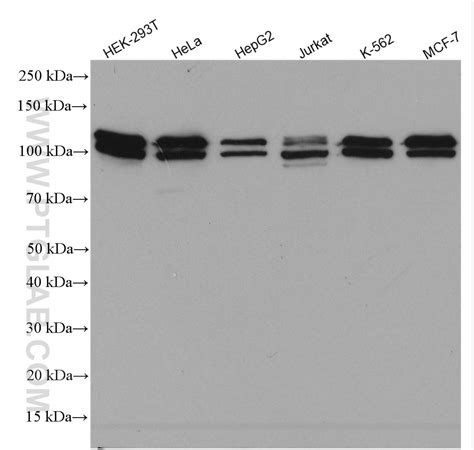 BRD3 antibody (11859-1-AP) | Proteintech