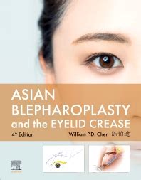 Asian Blepharoplasty and the Eyelid Crease - E-B: 4th edition | William ...