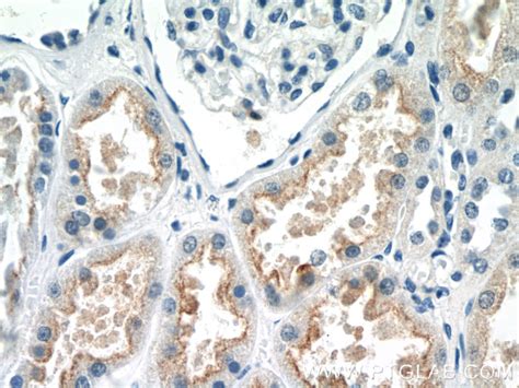 EFHD1 antibody (19854-1-AP) | Proteintech