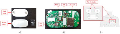 Arrhythmia Evaluation in Wearable ECG Devices