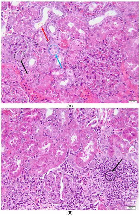 Curcumin and Vitamin C Attenuate Gentamicin-Induced Nephrotoxicity by ...