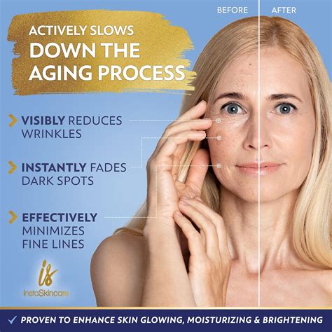 InstaSkincare Niacinamide Facial Serum 2Oz - Bovine India | Ubuy