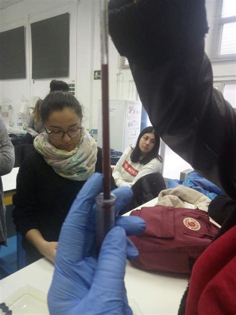 HEMATOLOGIA: PRACTICA 19: VELOCIDAD DE SEDIMENTACIÓN GLOBULAR.