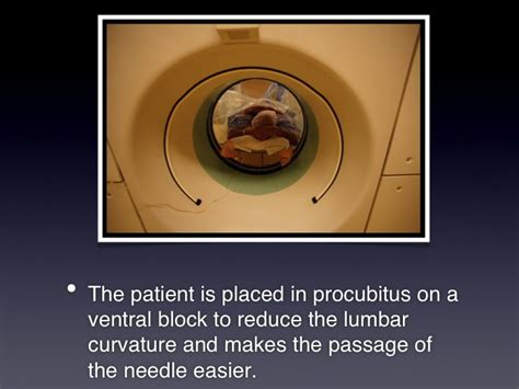 Image result for Disco Injection