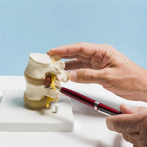 Cómo Desinflamar Una Hernia Discal | Doctor Online