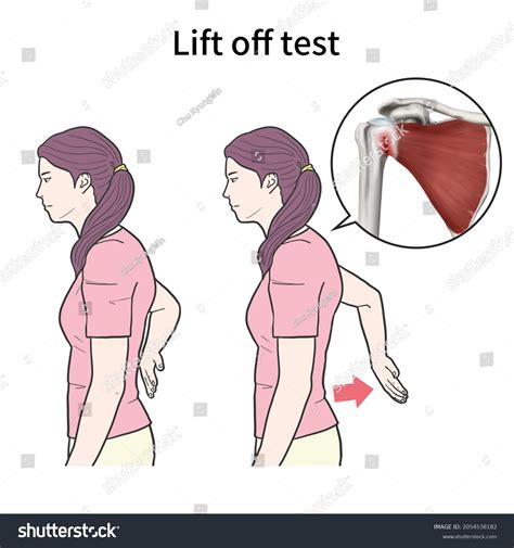3.ª Ilustración médica para explicar el: ilustración de stock ...