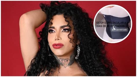 Así se ve Paola Suárez hoy tras someterse a una nueva cirugía estética: VIDEOS