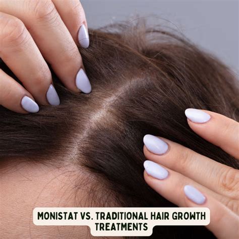 Monistat for Hair Growth: Separating Myths from Facts | Clinikally