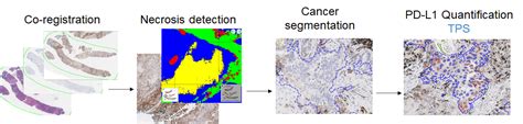 Knudsen-AP Research | Pathology | University of Utah Health