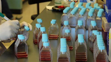 UGA researchers develop first test of cure for Chagas disease - Center ...