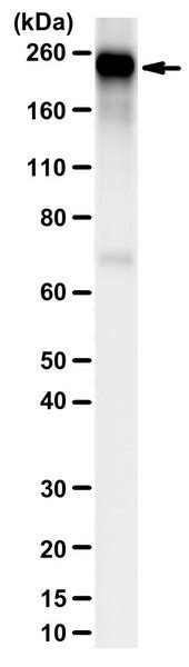Anti-Myosin Heavy Chain Antibody, clone A4.1025 | 05-716-I-100UL