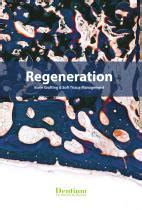 Tapered dental implant - SuperLine - Dentium - titanium / internal hexagon