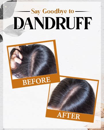 Buy myUpchar Ayurveda KeshArt Bhringraj Hair Anti-Dandruff Shampoo ...