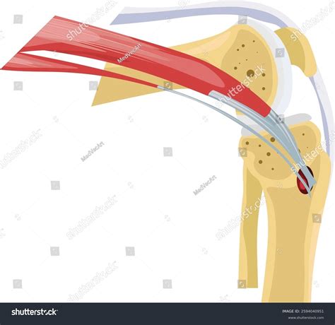 Pes Anserine Bursitis Knee Pain Vector Stock Vector (Royalty Free) 2594040951 | Shutterstock
