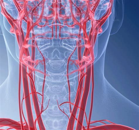 What Is Carotid Artery Disease? | YourCareEverywhere