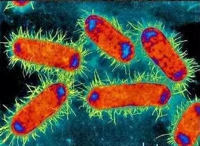 医院预防和控制多重耐药菌鲍曼不动杆菌感染的策略_腾讯新闻
