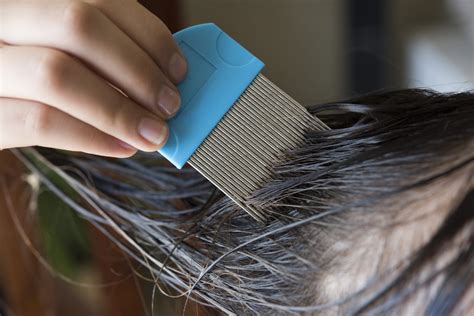 Can Washing Hair Remove Lice?