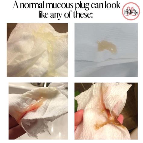 What Color Is The Mucus Plug Discharge