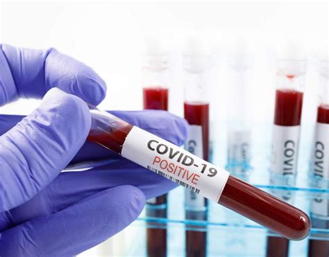 T20 World Cup: COVID-Positive Players Can Play As There Are No ...