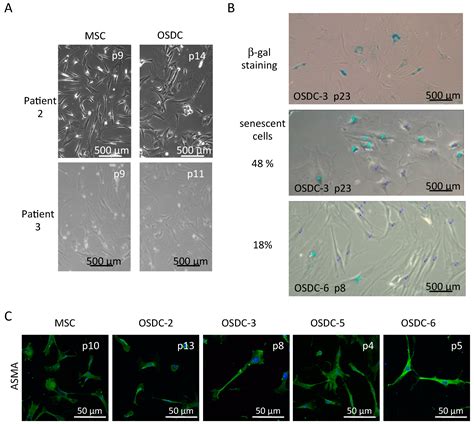 Comparison of Tumor- and Bone Marrow-Derived Mesenchymal Stromal/Stem ...