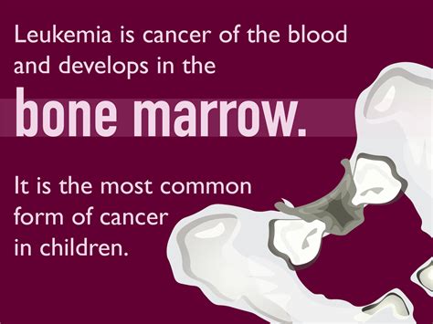 Pediatric Leukemia Symptoms and Signs | Dana-Farber Cancer Institute