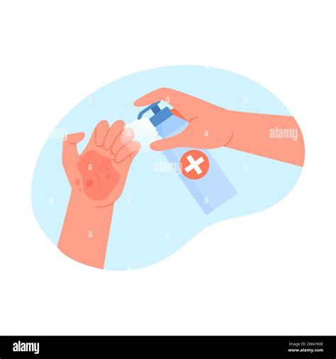 Injured hand disinfection. First aid, wound cleaning solution cartoon ...