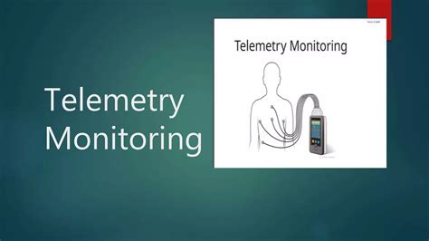 Image result for Telemetry Monitoring Basics